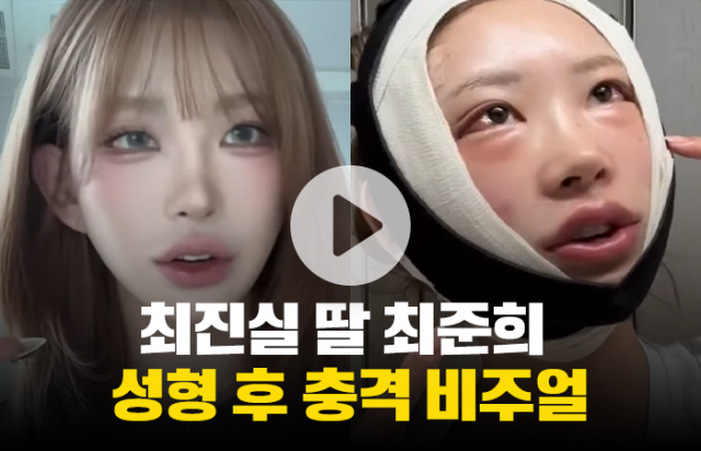 최진실 딸 최준희 성형 후 충격 비주얼