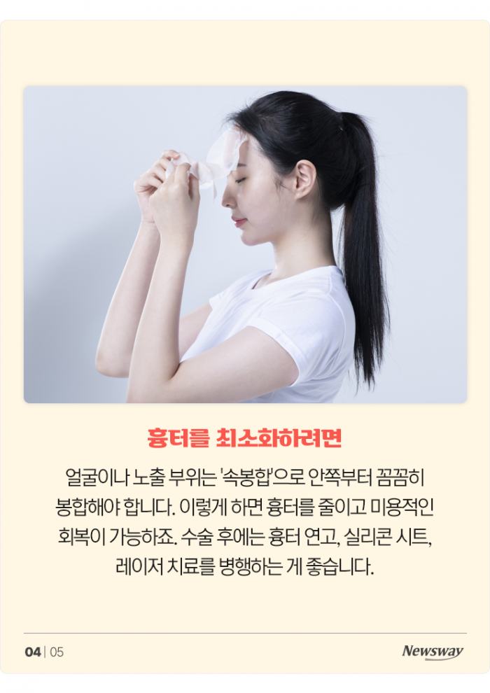 표피낭종, 여드름으로 착각 쉬운 피부 종양···재발·흉터 막으려면 정확한 진단과 치료 중요 기사의 사진