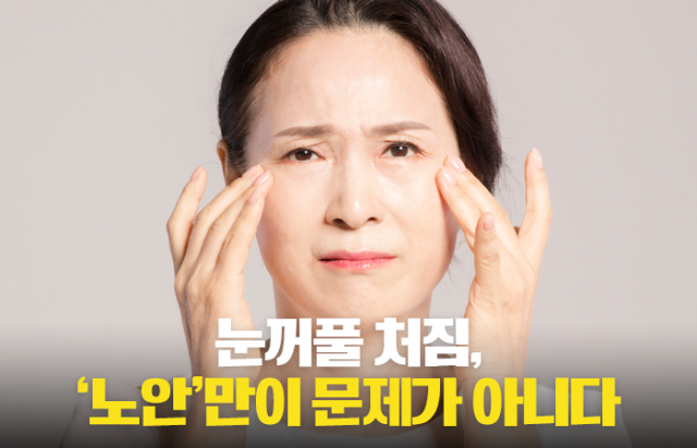 노화로 인한 눈처짐, 단순한 미용 문제로만 보기 어려워