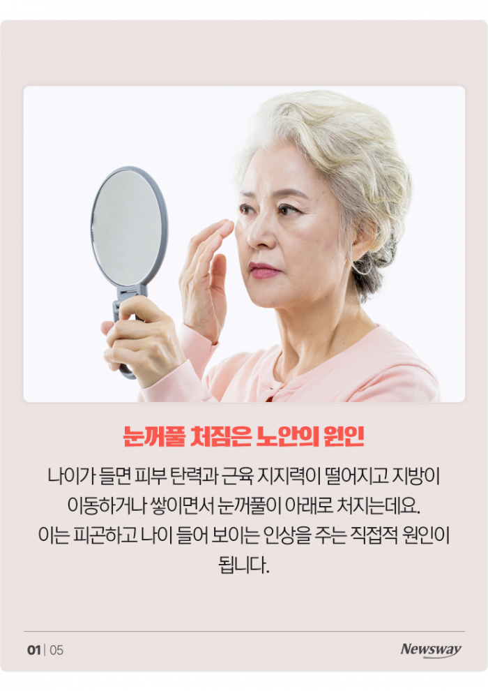 노화로 인한 눈처짐, 단순한 미용 문제로만 보기 어려워 기사의 사진