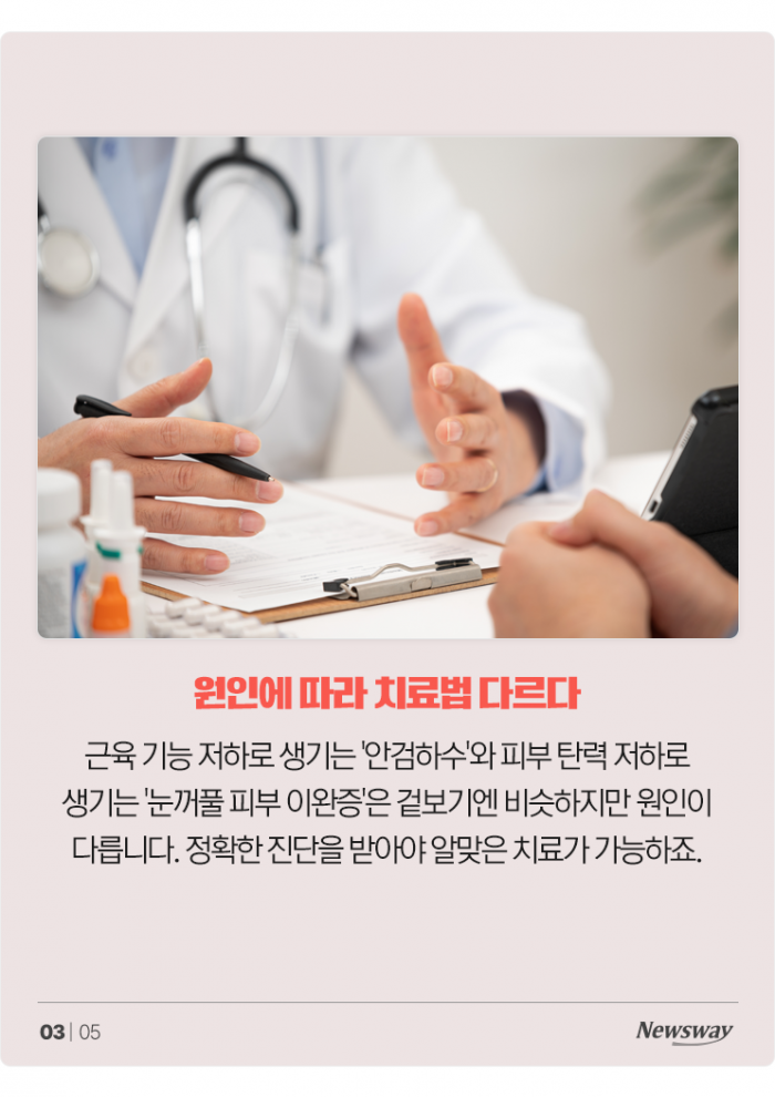 노화로 인한 눈처짐, 단순한 미용 문제로만 보기 어려워 기사의 사진