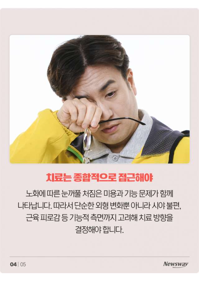 노화로 인한 눈처짐, 단순한 미용 문제로만 보기 어려워