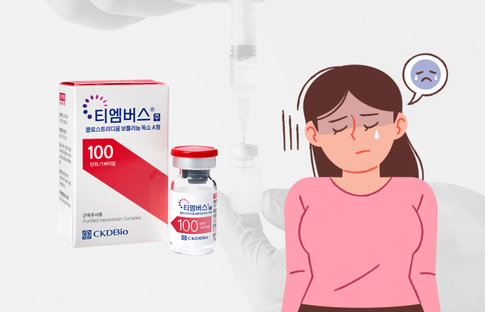 보톡스로 우울증 치료?···종근당바이오, '티엠버스' 적응증 확장