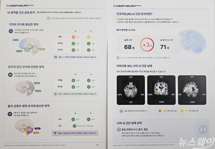 딥뉴로 브레인세그로 분석한 '뇌 건강 분석 리포트' 일부. 사진=임주희 기자